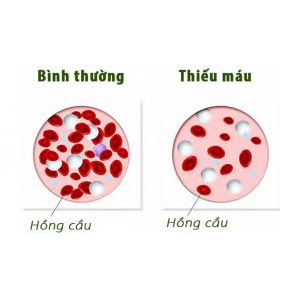 6. Phòng bệnh thiếu máu do thiếu sắt