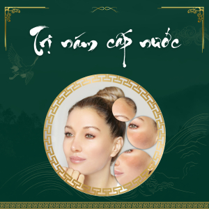 Trị Nám Cấp Nước